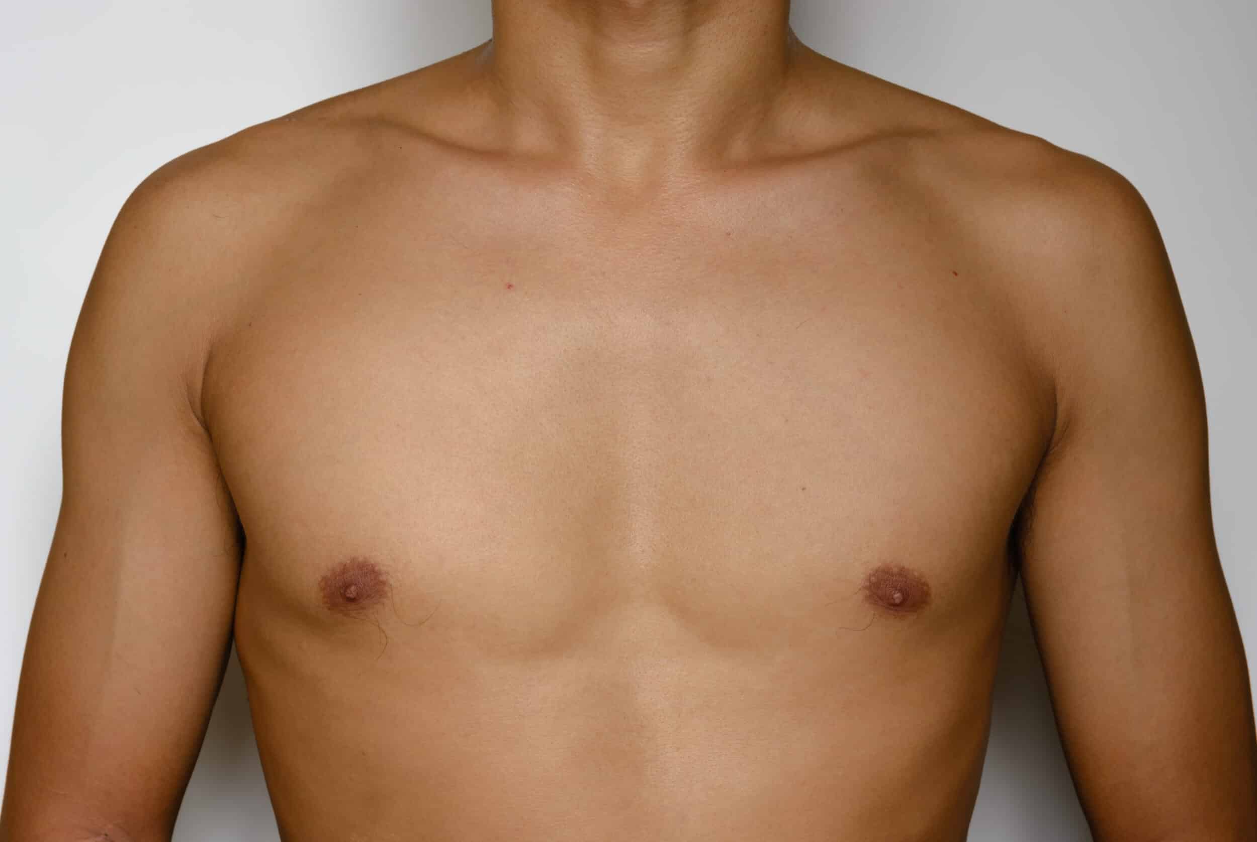 Flat male chest shows a firm physique after getting rid of excess fat